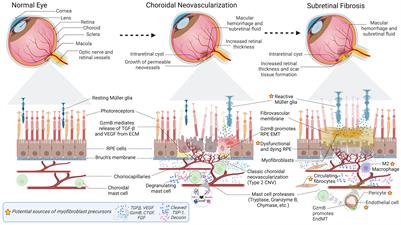 Exploring the role of granzyme B in subretinal fibrosis of age-related macular degeneration